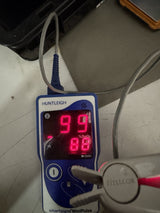 Huntleigh SmartSigns MiniPulse MP1 Pulse Oximeter with SpO2 Finger Sensor