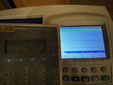 Welch Allyn CP 200 ECG Machine with Patient Cables & Mobile Stand – Tested